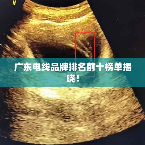 广东电线品牌排名前十榜单揭晓!